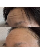 ディオーネ 岡崎店(Dione)/《テラボーラー》