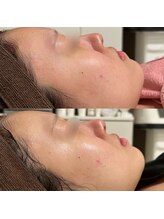 シーラックス(Sealax)/水光白玉肌