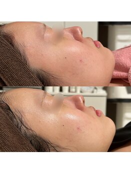 シーラックス(Sealax)/水光白玉肌