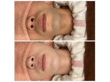 ラ ボーテ(La Beaute)の雰囲気（清潔感UP！メンズ脱毛/ヒゲ脱毛お任せ下さい！肌質変わります！）