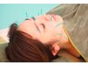 【美容鍼+首の整体】痛みが少ない！肌質改善にも♪