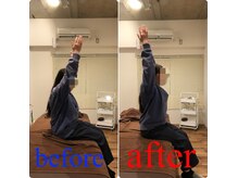 肩こりで腕が上がらない人もこの変化！！肩こり/頭痛