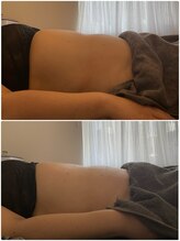 ウル(Ulu)/腸もみビフォーアフター