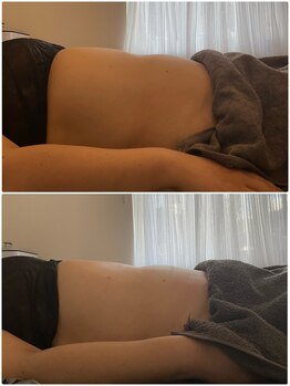 ウル(Ulu)/腸もみビフォーアフター