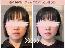 ヨサパーク ミィ(YOSA PARK mii)/デトックスで小顔になれちゃう！