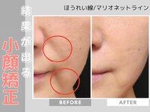 ソワンボーテ(Soin Beaute)