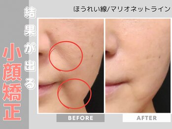 ソワンボーテ(Soin Beaute)