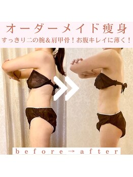 トータルビューティージュネス(JEUNESSE)/薄いお腹/くっきり肩甲骨!