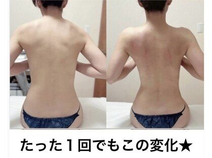 リュミエール(umiere)の写真