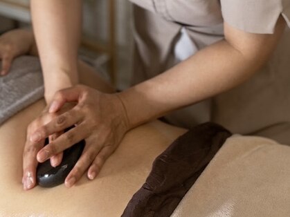 ヒールパーム(Heal Palm)の写真