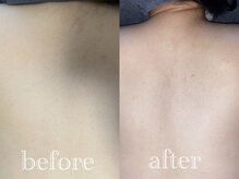 マドンナリリー 恵比寿店(Madonna Lily)/背中