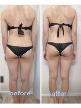 リアン(Lien)/before after