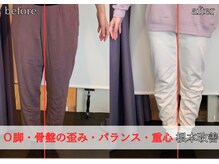 リベスト(RE:BEST)/骨格矯正/Ｏ脚/骨盤の歪み