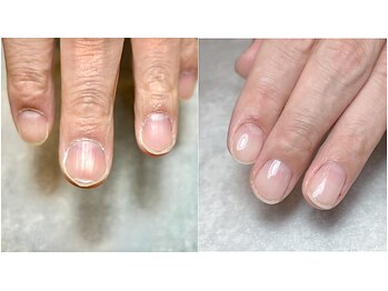 アンドアールネイルズ(and..R nails)/＊施術イメージ