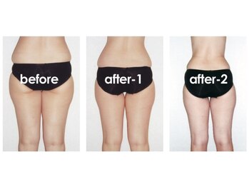 ラブランフェアリー/身体の中をリセット！