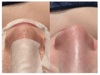 パルティール 新宿東口店 partir/