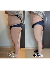 リルーチェ 倉敷(Riluce)/ぽっこりお腹撃退