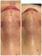ディア(DiA)の写真/《毛穴の黒ずみ・開き・しみ・シワ・たるみ改善に！》お肌のお悩みに合わせて施術内容をカスタマイズ♪