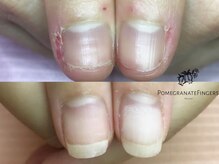 ポミグラニットフィンガーズ(Pomegranate Fingers)/爪周りの肌もツルツル