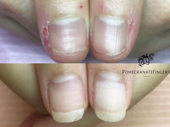 ポミグラニットフィンガーズ(Pomegranate Fingers)/爪周りの肌もツルツル
