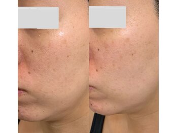 スプレール 水戸店/VOSサロンケア