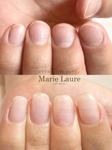 マリーロール 淀屋橋本店(Marie Laure)/自爪育成/深爪矯正/ネイルケア