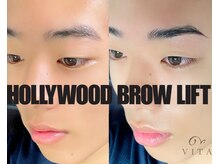 ヴィータ(VITA)/ハリウッドブロウリフト