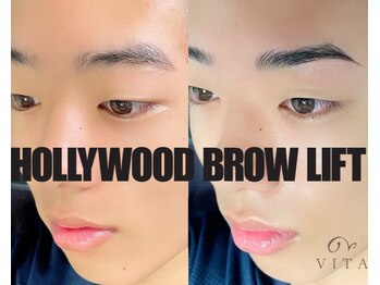 ヴィータ(VITA)/ハリウッドブロウリフト