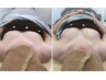【平日限定ゲリラクーポン】極乳トリートメント/9,980円