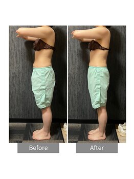 ヒヨリ(hiyori)/《before/after》body