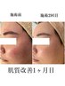 【肌改善入門】全国症例数No,1のドクターリセラ×AI肌診断☆本格ケア体験
