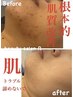 【最強艶肌特化】ハーブピーリング専門店《どんな肌悩みも解決》¥11.000