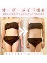 トータルビューティージュネス(JEUNESSE)/ぽっこりお腹もこの通り♪