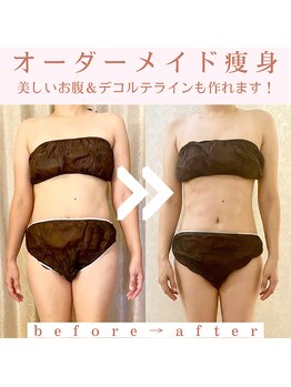 トータルビューティージュネス(JEUNESSE)/ぽっこりお腹もこの通り♪