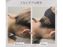 ジョエルワックス 沖縄コザ店(JOELLE WAX)の雰囲気（手の届きづらいうなじや背中をダブル脱毛で後ろ姿美人に！！）