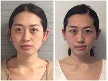 美容整体 ウェリナ 蟹江院/小顔矯正/骨盤矯正/美脚サロン 