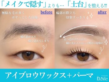 エトワール(Etoile)/隠すのではなく土台を整える♪
