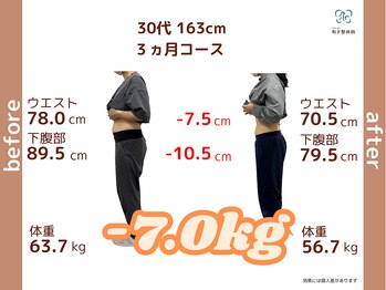 和ぎ整体院の写真/30代から50代へ!運動なしで痩せておしゃれを楽しみたい方の理想をサポート◎