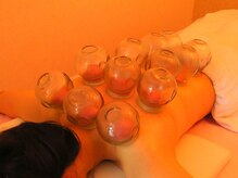 百草堂 栄店/カッピングで血行促進！