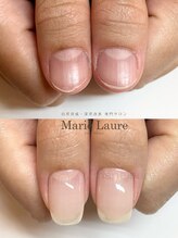 マリーロール 淀屋橋本店(Marie Laure)/自爪育成/深爪矯正/ネイルケア