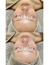 クレヴィー(Creviy)/陶肌トリートメント《Special》