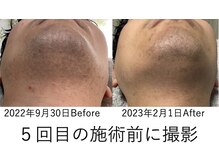 デュポン 南古谷店(Dupont)の雰囲気（女性、男性どちらも施術可能◎まずはお試し下さい！）