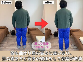 東林間整骨院/首と肩の傾きが改善
