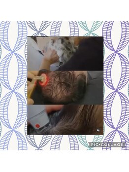 パールブルー(All Perl blue)/育毛促進ヘッドスパ