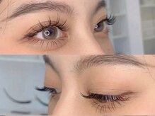 アイブライト(EYE Bright)