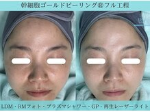 リメイク 広尾(REMAKE)/