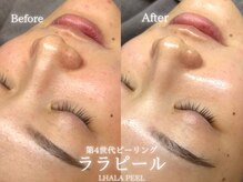 リル 和歌山市店(lilou)の雰囲気(圧倒的ツヤ肌になれる!ララピール☆)