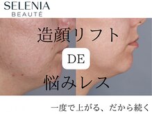 セレニア ボーテ(Selenia Beaute)の雰囲気（9割以上の方が変化を実感！いつ見ても上向きの若々しい印象へ。）