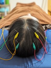 乃々鍼灸整体院 表参道/鍼灸×整体