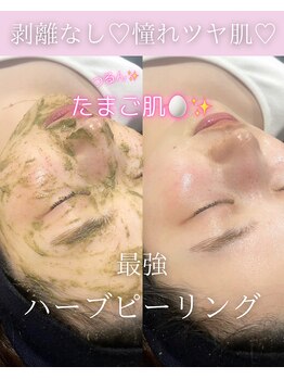 シンプル 中野(Simple)の写真/ホームケアでは物足りない方【ハーブピーリング/モデリングパック/BIHAKUセラム】透明感素肌かなえます！